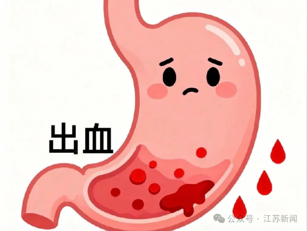 《我在故宫修文物》导演因急性胃出血离世，“小胃炎”为何变成致命胃出血？