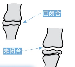这个春天，你“蹿个儿”了吗？