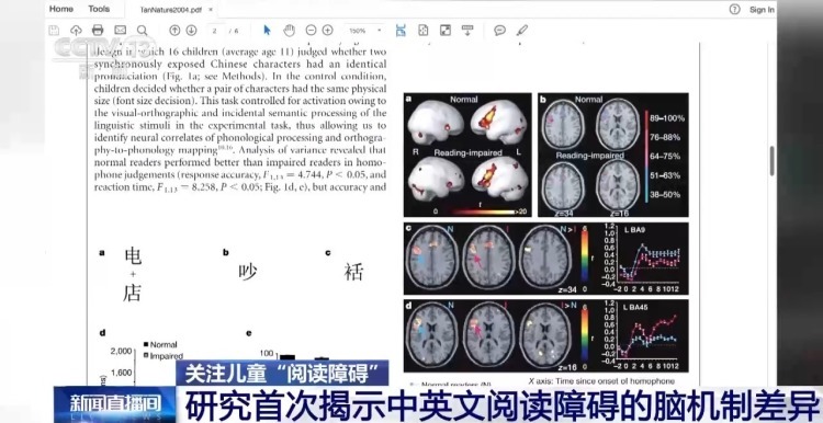 孩子写字像“画画”、朗读总跳行？警惕阅读障碍这5个早期信号