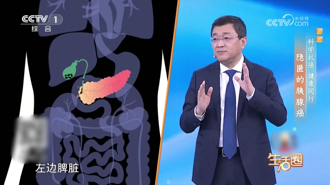 胃不适、腰背酸、血糖高？警惕“癌王”发出的预警信号