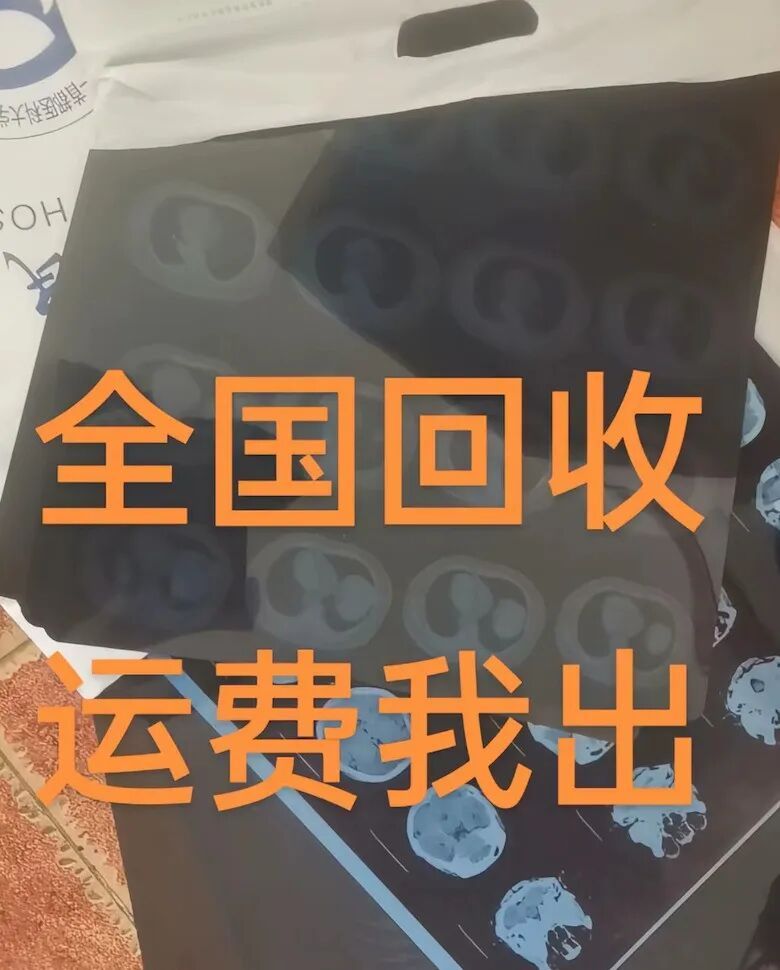 CT胶片高价回收？紧急提醒：别卖！别卖！