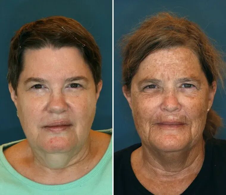 双胞胎看起来竟然差10岁！这个生活习惯真的让你更显老，现在改还来得及