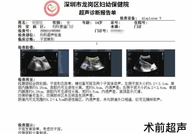 14岁少女直冒冷汗，痛到无法上学，一查竟有两个子宫！医生提醒️