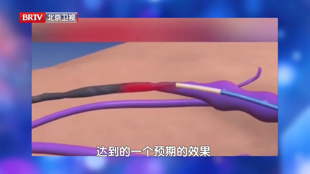 一个常见的习惯堵血管，动动脚预防血栓