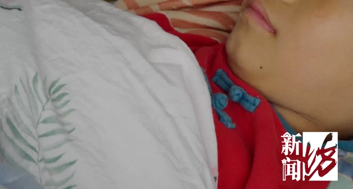 “双胞胎兄弟残留在咽喉”，有软骨有脂肪！6岁男孩饮食习惯不对劲，医生一查惊了…