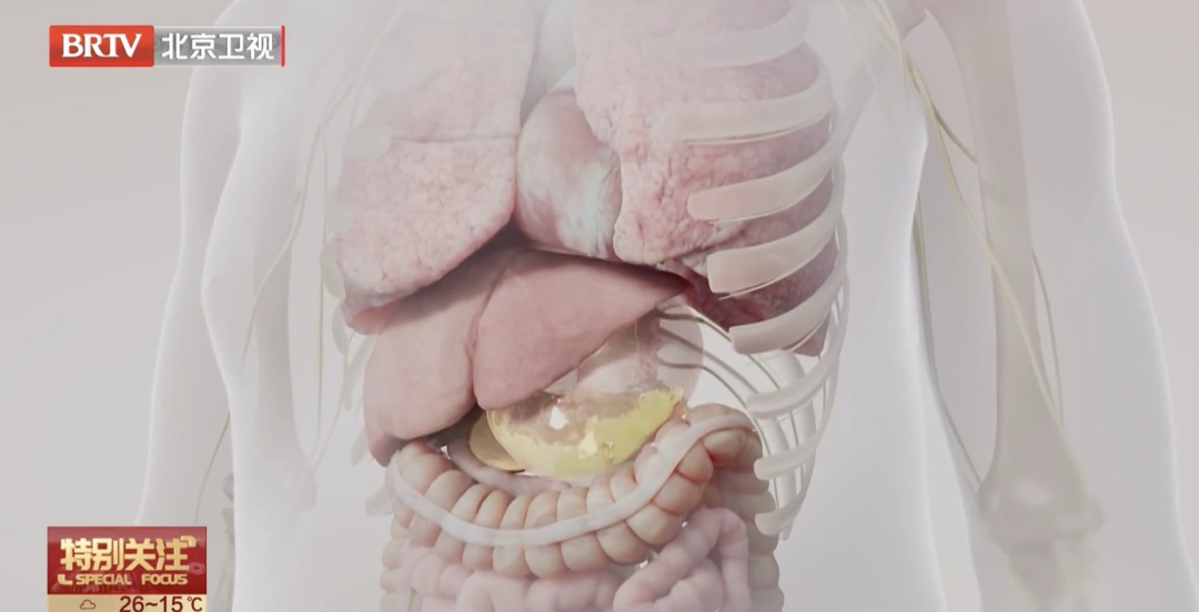 每三人就有一人中招！最终可能发展成肿瘤！专家提醒——