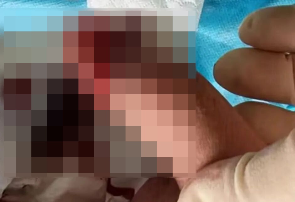 10秒！辅警赵闻博挺身挡刀，手指骨折仍不后退……