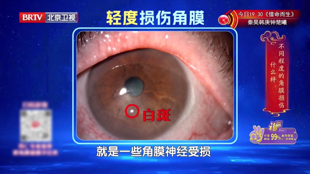 一个毁掉视力的习惯，你可能天天做，2个动作给双眼“补补水”，酸胀疲劳都赶跑