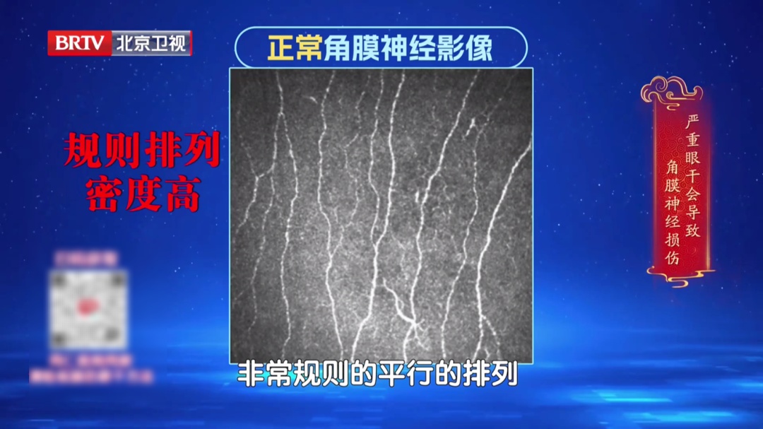 一个毁掉视力的习惯，你可能天天做，2个动作给双眼“补补水”，酸胀疲劳都赶跑