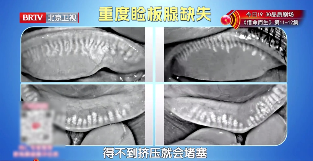 一个毁掉视力的习惯，你可能天天做，2个动作给双眼“补补水”，酸胀疲劳都赶跑