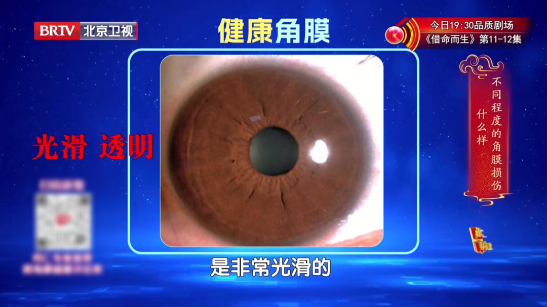 一个毁掉视力的习惯，你可能天天做，2个动作给双眼“补补水”，酸胀疲劳都赶跑