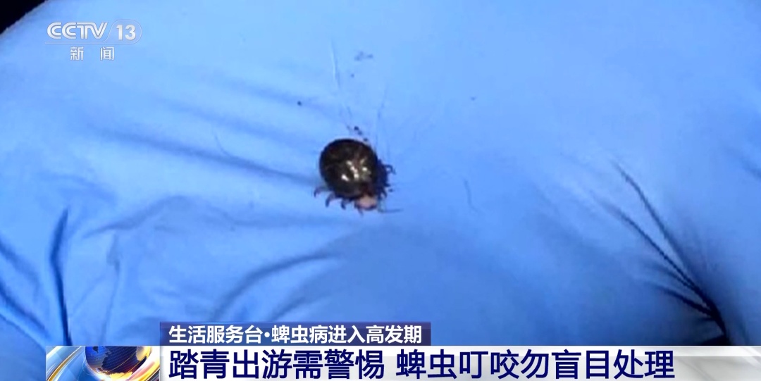 一人身上拔出17只蜱虫！被叮咬后绝对不要这样处理→