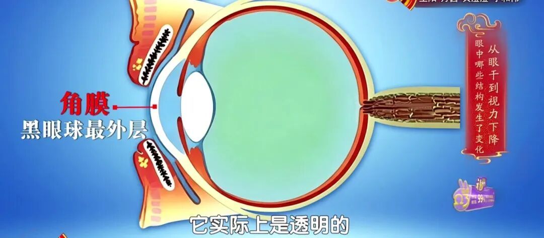 一个毁掉视力的习惯，你可能天天做，2个动作给双眼“补补水”，酸胀疲劳都赶跑