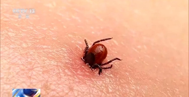 一人身上拔出17只蜱虫 这份防虫攻略请收好