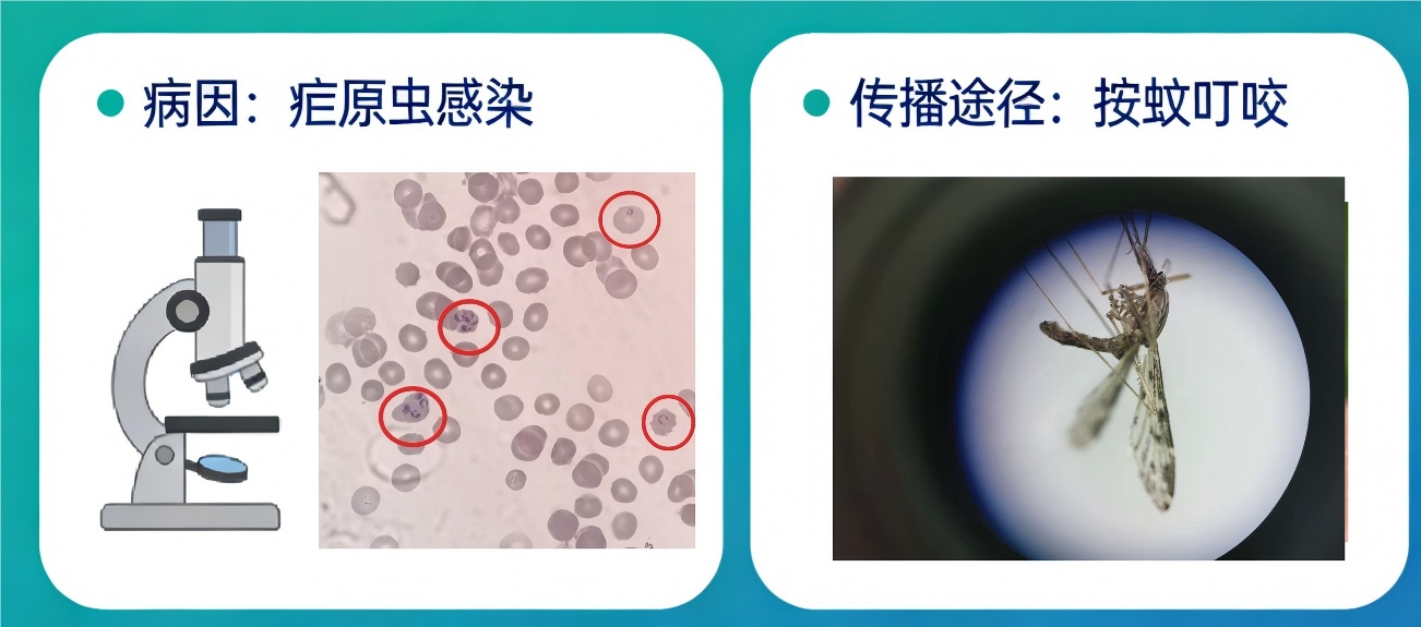 重症可导致肾衰竭、休克 这份疟疾防护指南请收好