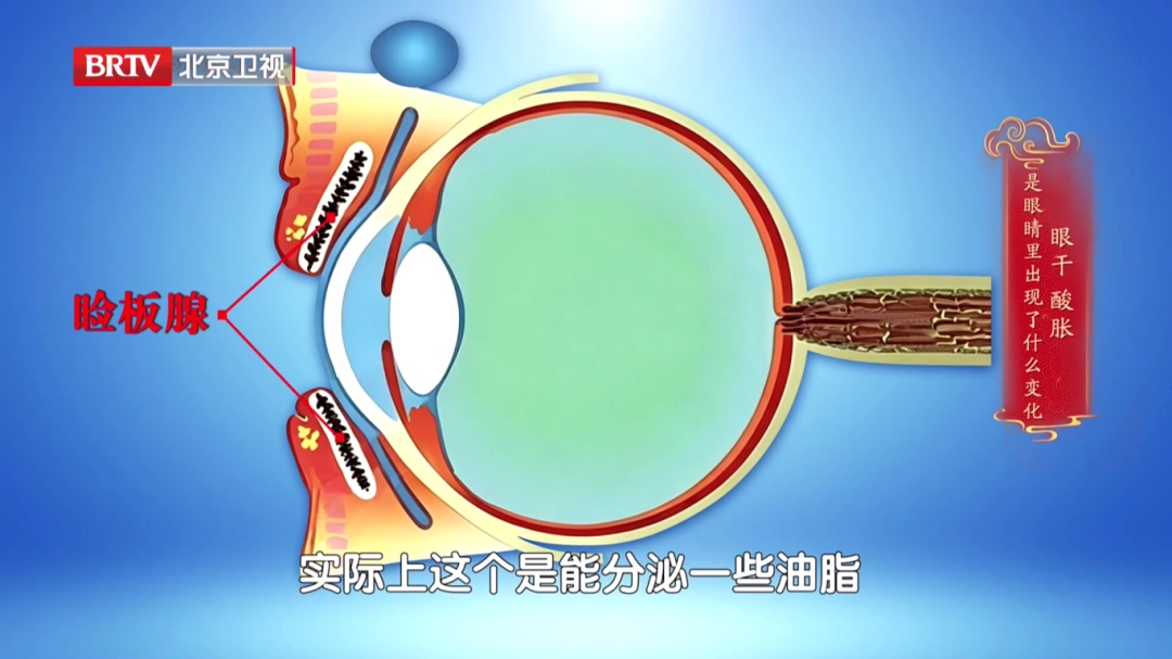 一个毁掉视力的习惯，你可能天天做，2个动作给双眼“补补水”，酸胀疲劳都赶跑