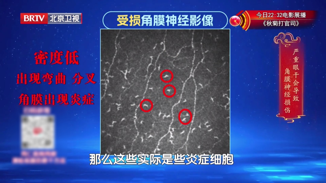 一个毁掉视力的习惯，你可能天天做，2个动作给双眼“补补水”，酸胀疲劳都赶跑