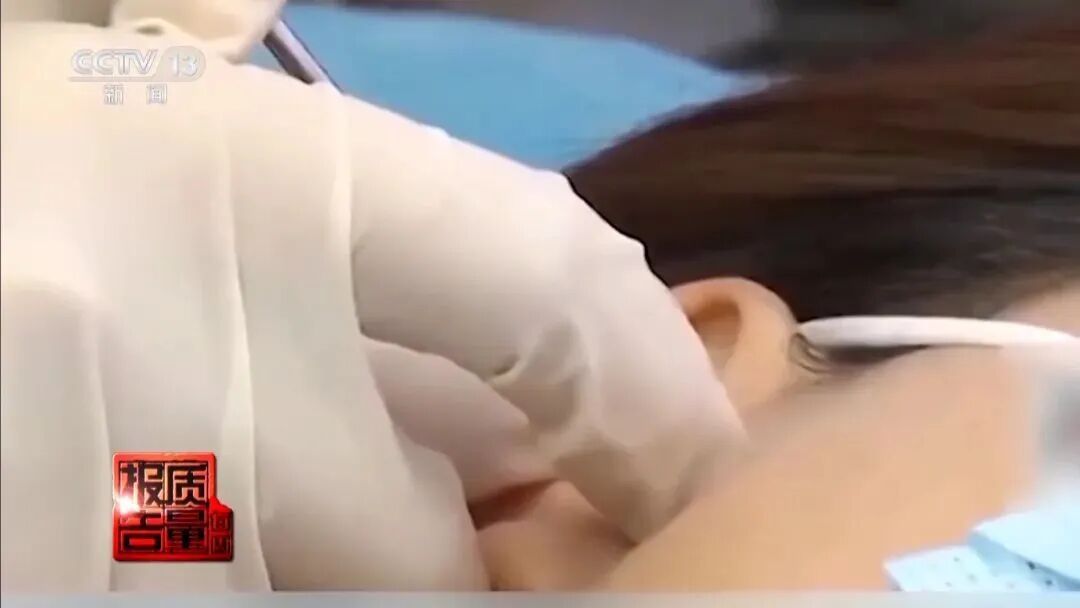 “麻药一过，生不如死”，央视揭秘“精灵耳”整形乱象：有人落下终身残疾