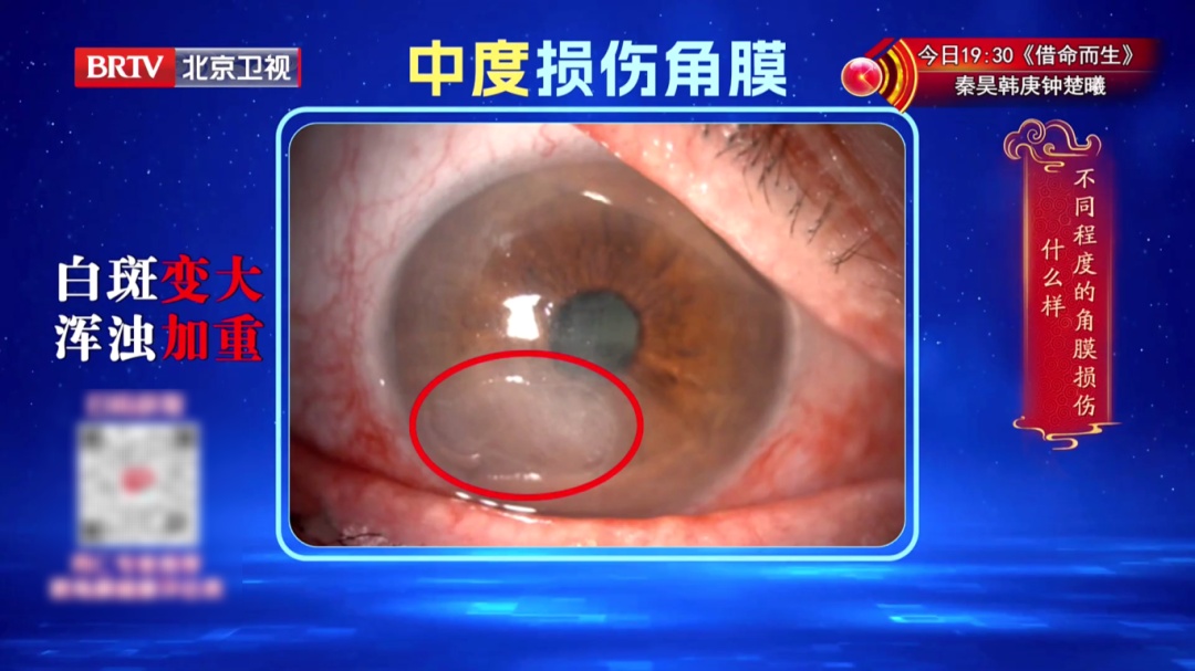 一个毁掉视力的习惯，你可能天天做，2个动作给双眼“补补水”，酸胀疲劳都赶跑