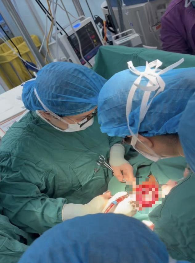 29岁孕妈体重不到90斤体内藏巨大肿瘤，专家精细手术保胎如同拆弹
