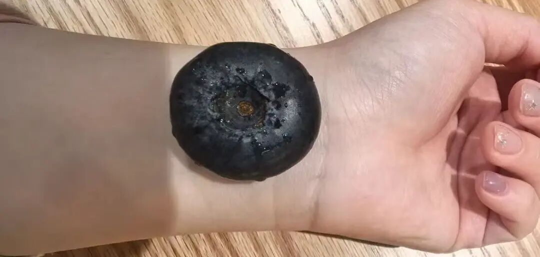 一种春天必吃的“浆果之王”，可能把你送进医院！3个细节，再馋也得注意