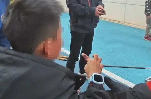 男孩食指被卡断！有些东西坏了，别让孩子自己修......