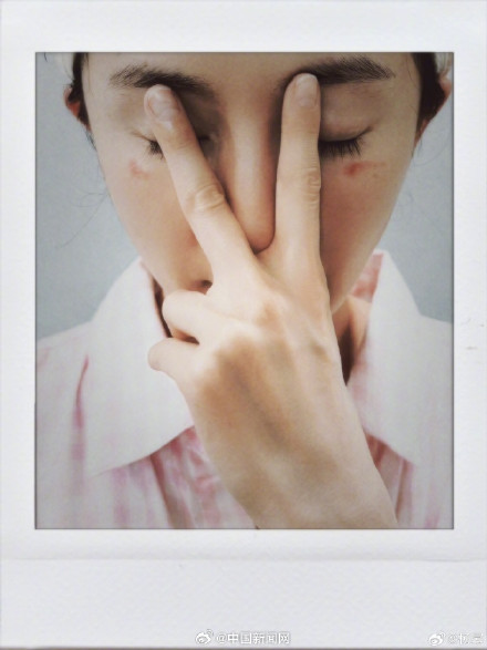 长时间佩戴蒸汽眼罩或导致视力下降