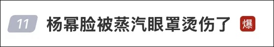 知名女演员晒照，脸部遭烫伤！不少网友慌了：“我也这么干过，以后再也不敢了…”