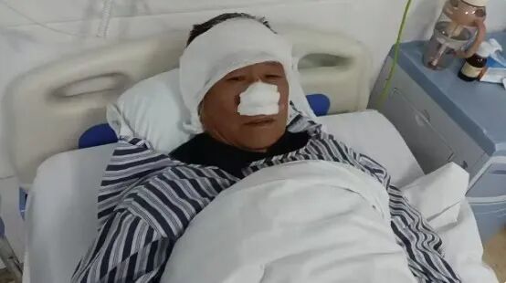 震惊 | 70岁老人与歹徒搏斗被咬掉鼻子！还吞入肚中！当地回应！