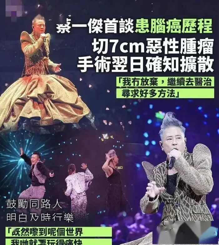 知名歌手自曝脑癌已扩散
