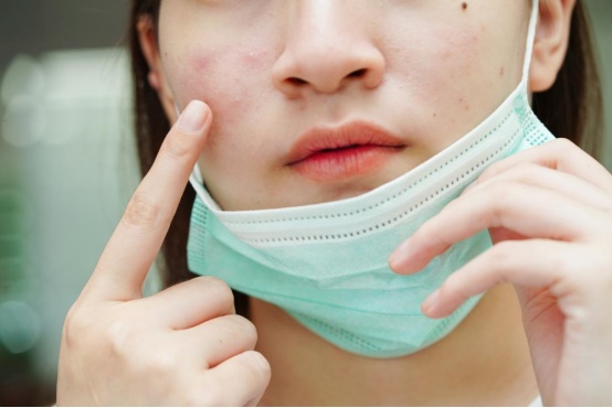 反复过敏就是免疫力差？这些用药误区，反而会加重过敏症状