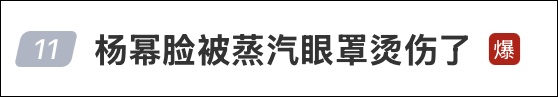 杨幂晒被烫伤照，热搜爆了！网友后怕：“我每次都是戴着睡觉，再也不敢了……”