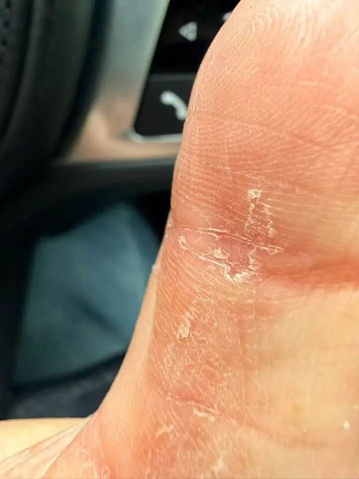 “痒到怀疑人生！”女子朋友圈一张照片炸了：原来这么多人都有？