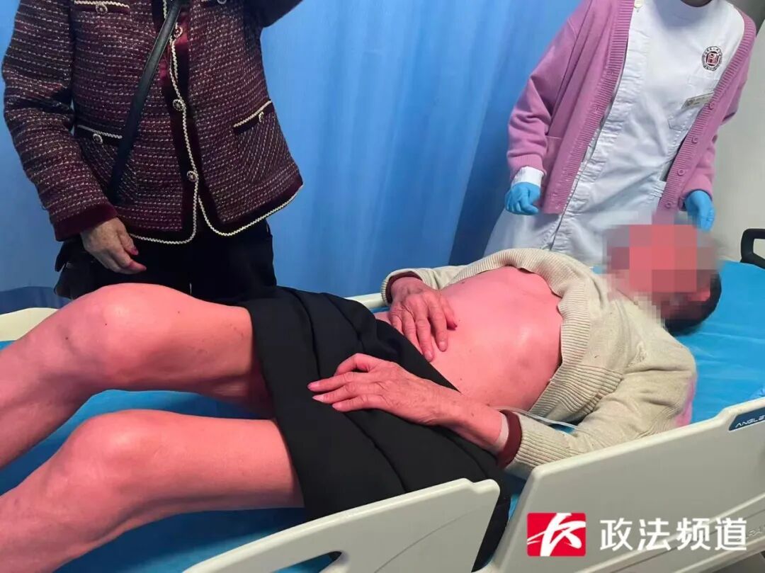 险！老人误服红色染料变“小红人”