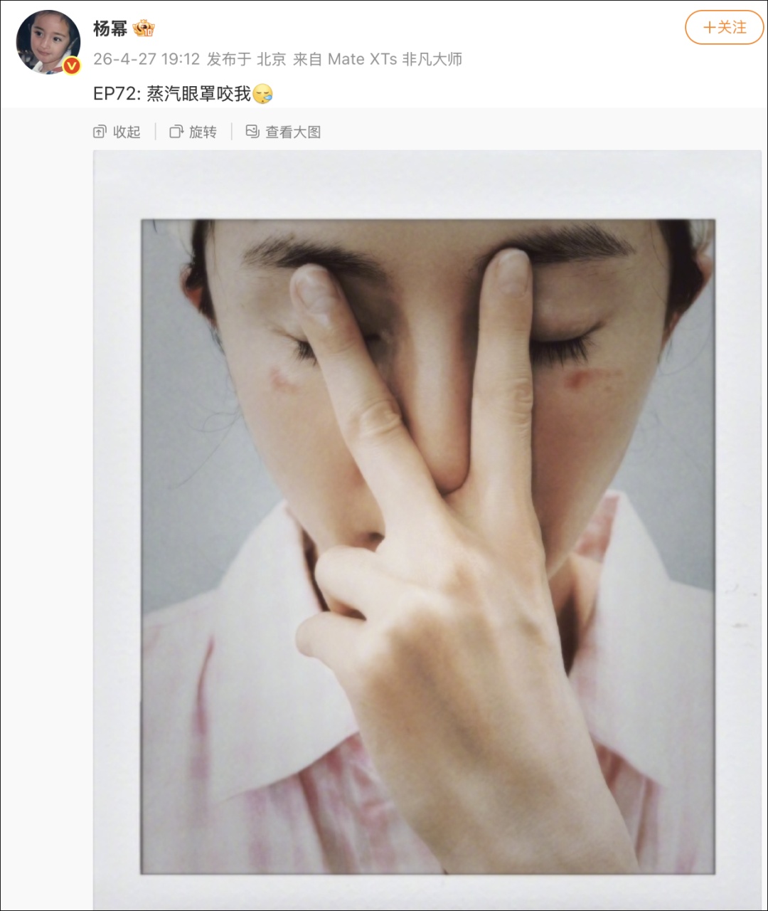 杨幂晒被烫伤照，热搜爆了！网友后怕：“我每次都是戴着睡觉，再也不敢了……”