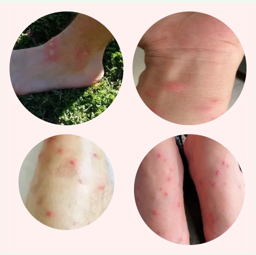 别碰、别踩！发现这种蚂蚁请立即上报