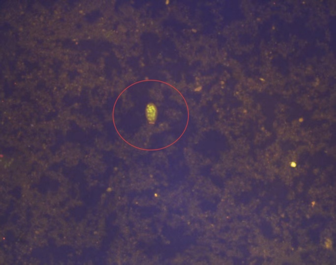 一家六口人因为一盘鱼生中招！医生：不煮熟根本杀不死！