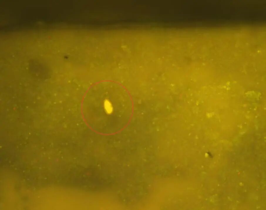 一盘鱼生放倒一家六口，医生：一级致癌物、感染后可寄生数十年