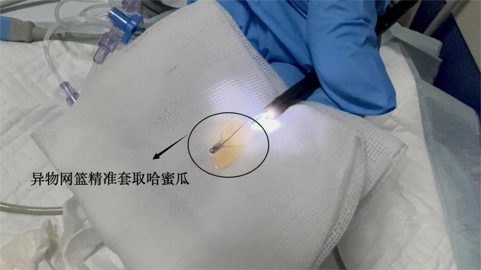 一块哈密瓜差点要了71岁老人的命，呼吸科专家：这类人群进食一定要警惕