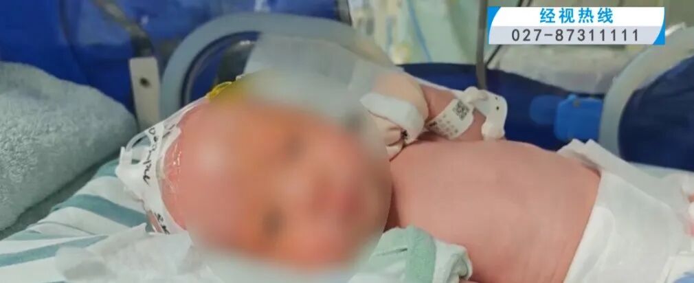 月嫂太累打瞌睡，致新生儿坠地颅内出血！父母索赔20万