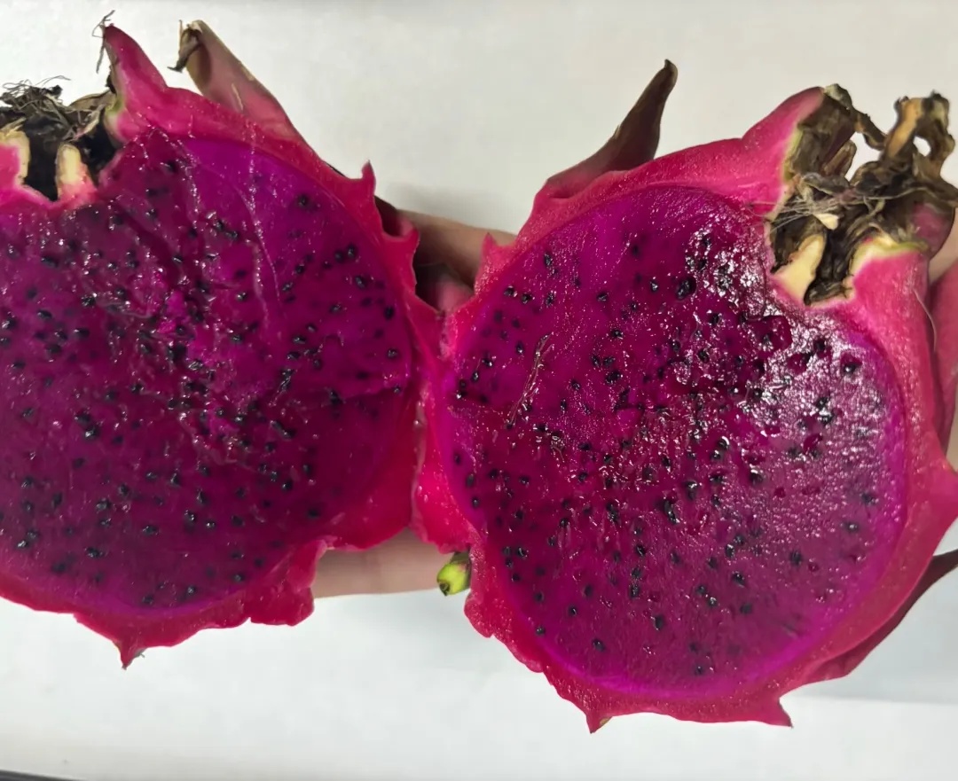 18岁女孩持续三五年大便出血，每次排便出血量达三五百毫升，因失血性休克抢救