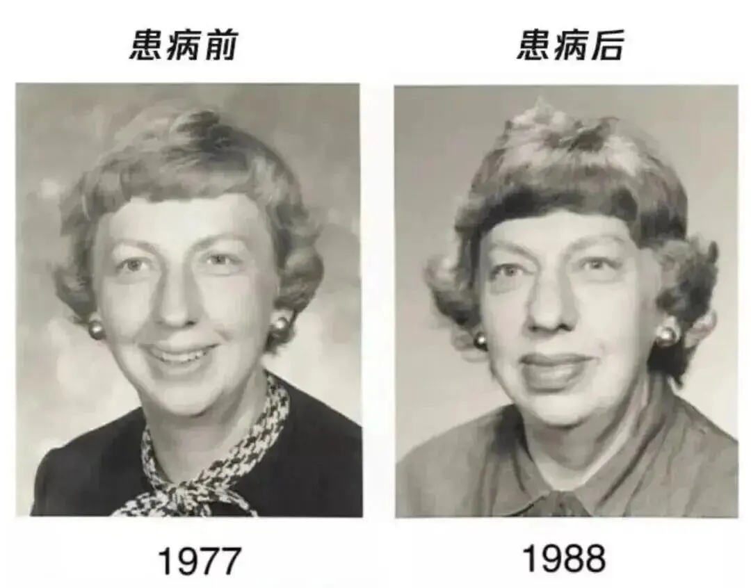 这种面相不是“发福”，可能是身体的求救信号！