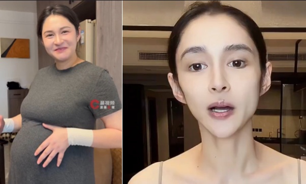 36岁女演员从175斤到暴瘦脱相！医生提醒