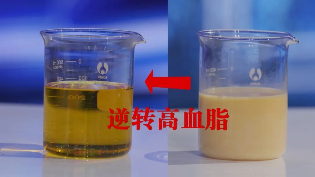 降脂黄金期到了！这2处每天敲一敲，痰浊消、血管清，血脂稳稳往下走