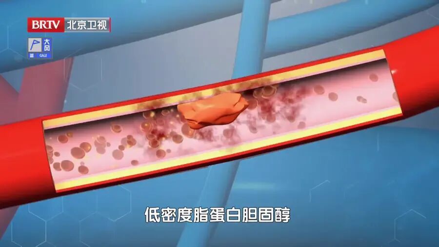 比跑步安全，比走路高效，每天这样蹲一蹲，肚子小了、心肺好了，腿脚有劲人不老