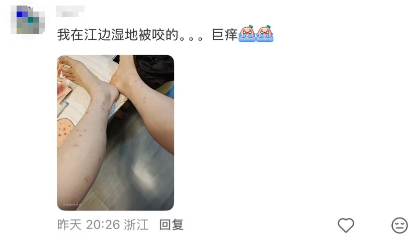 头皮发麻！女子出了一趟门，腿上密密麻麻长满...近期猛增，不少人已中招！