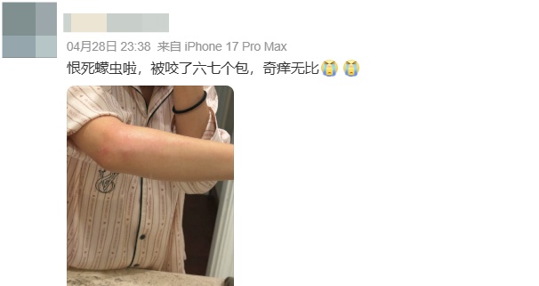 杭州女子抓狂：出了一趟门，腿上全是红色小疙瘩！不少人已中招，“元凶”原来是它