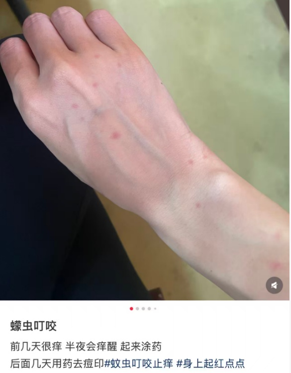 头皮发麻！女子出了一趟门，腿上密密麻麻长满...近期猛增，不少人已中招！