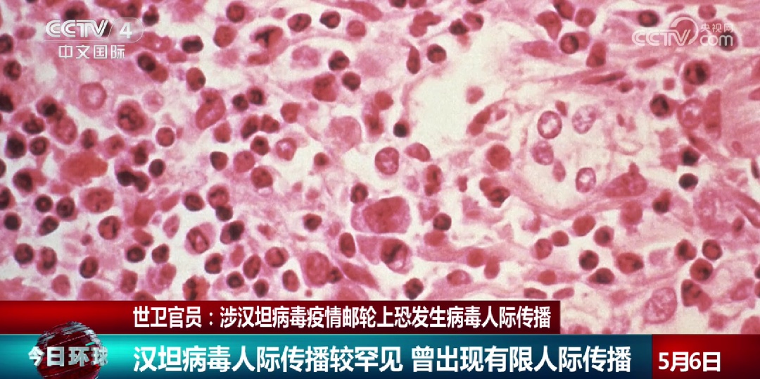 “恐发生人际传播！”大西洋涉疫游轮情况