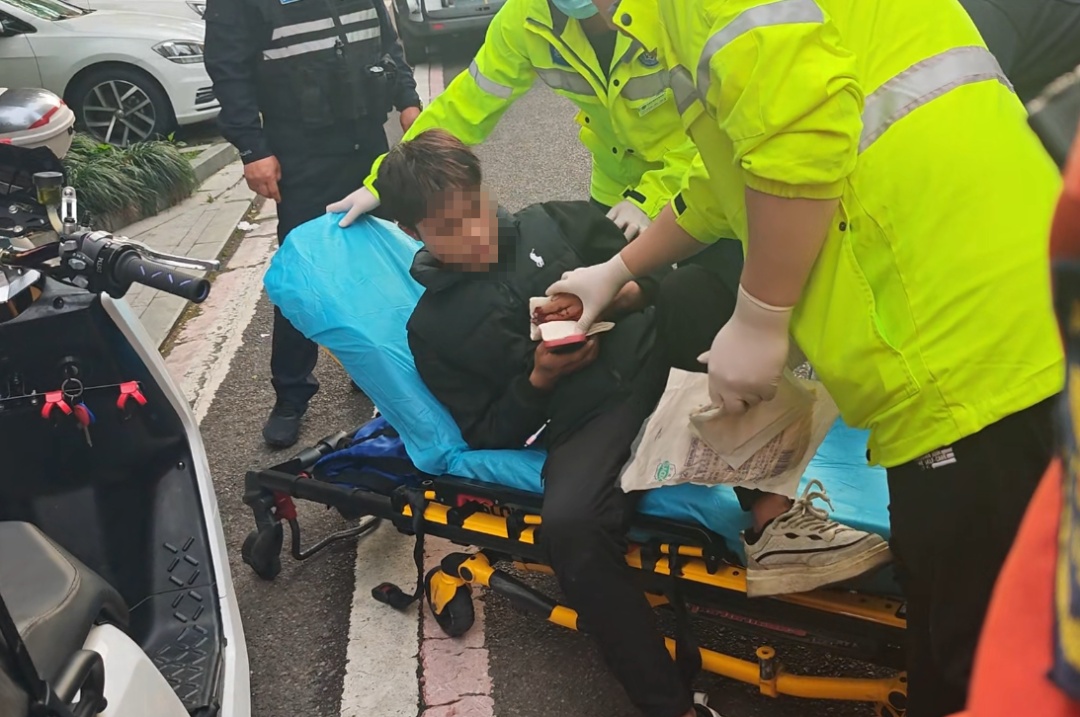 外卖员私自改装电动自行车，结果险失三指！